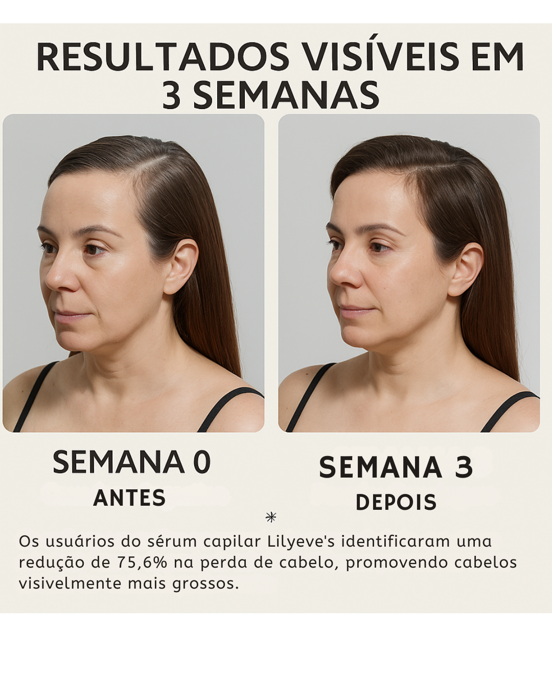 Lilyeve Hair Grow Care Serum Anticaída con Exosomas – Ampolla Coreana 100 ml