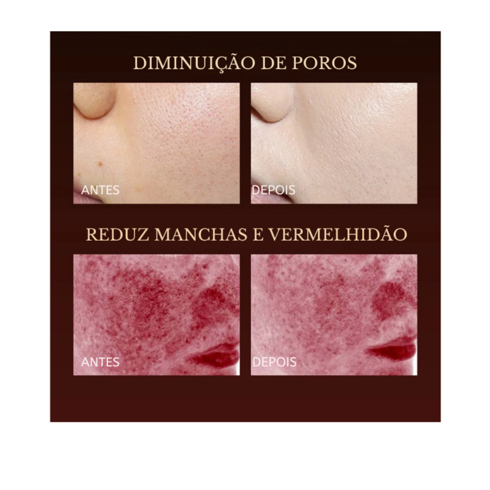 ✨ Mascarilla Facial LED de Silicona Photon High – Reducción de Manchas, Líneas Finas y Acción Antiacné