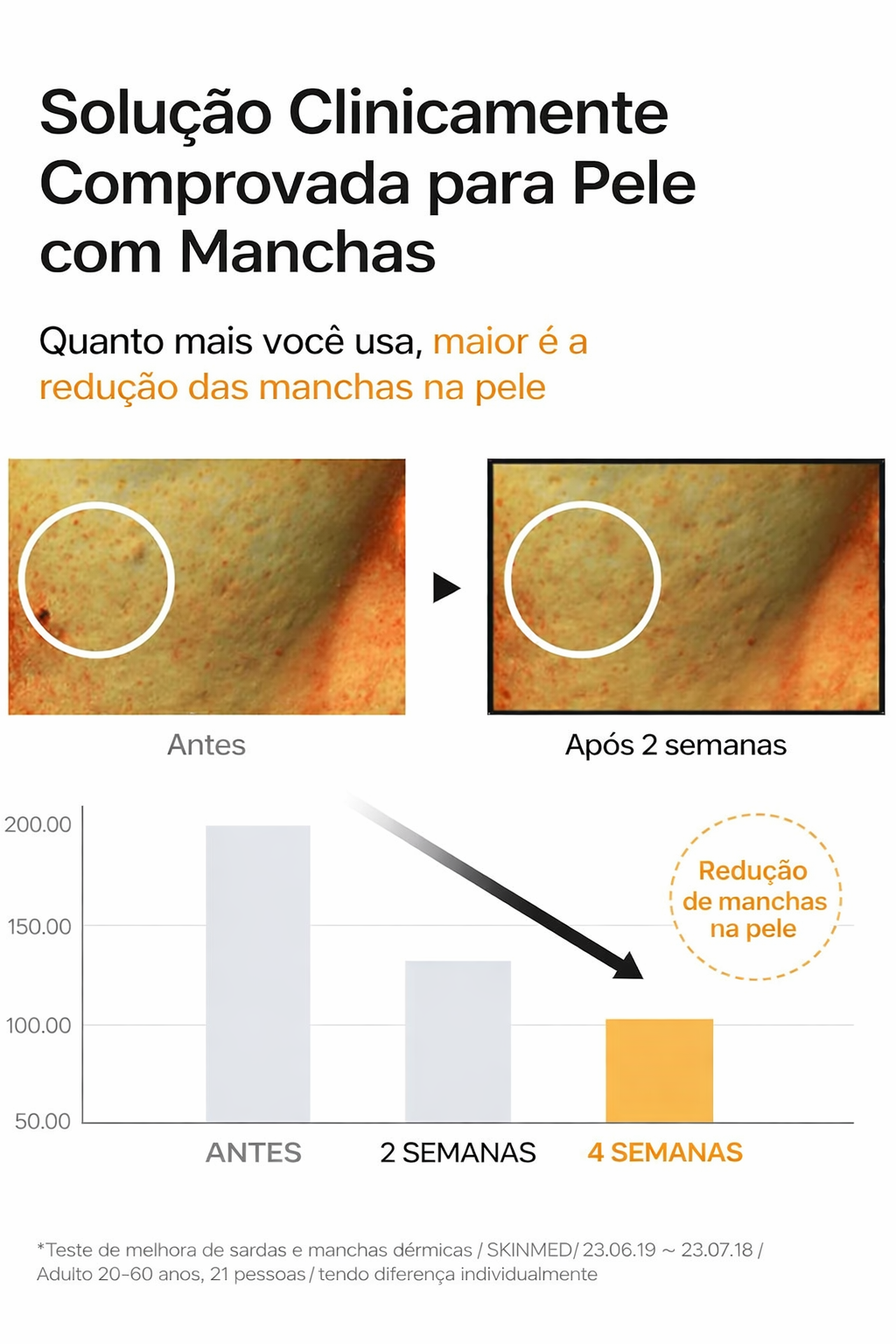 Serum Antimanchas CELIMAX – Niacinamida 5% + Ácido Tranexámico 3% – Corrector de Poros y Manchas Oscuras (30ml)