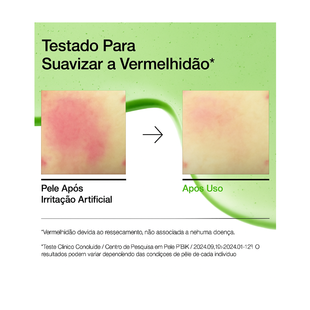 Sérum de Ácido Azelaico 10% ANUA – Anti-Rojeces, Calmante y Acción Anti-Acné