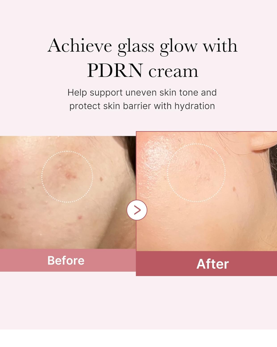 VT COSMETICS PDRN Capsule Cream 100, Korean Facial Moisturizer with 100,000 ppm PDRN, Hyaluronic Acid & 9 Peptides for Hydration, Firmness & Glow