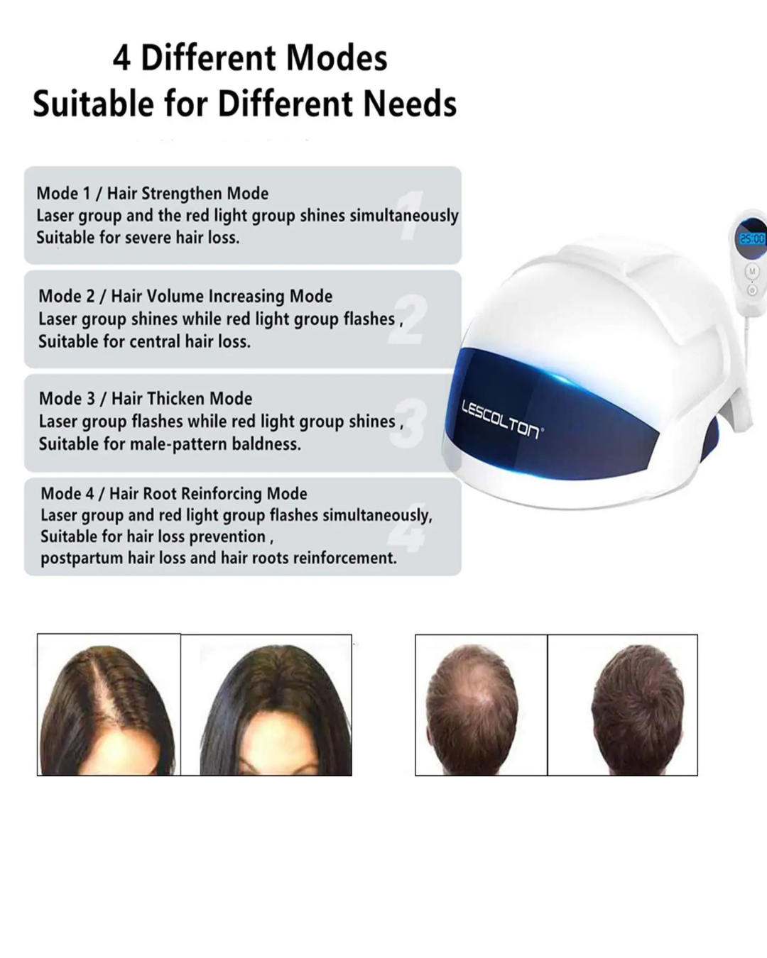Lescolton D601 Red Light Laser Therapy Cap – LLLT Hair Growth Cap for Hair Thinning &amp; Scalp Care