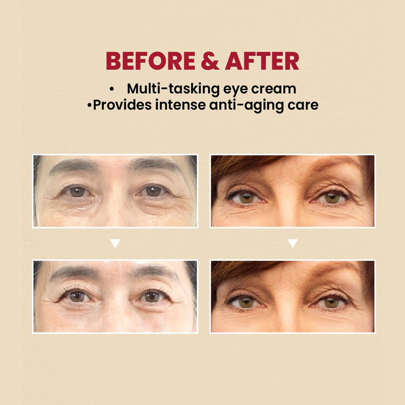 Crema para el Contorno de Ojos SEOUL 1988 con Retinal 4%, Péptidos y Bakuchiol – Acción Antiseñales y Firmeza