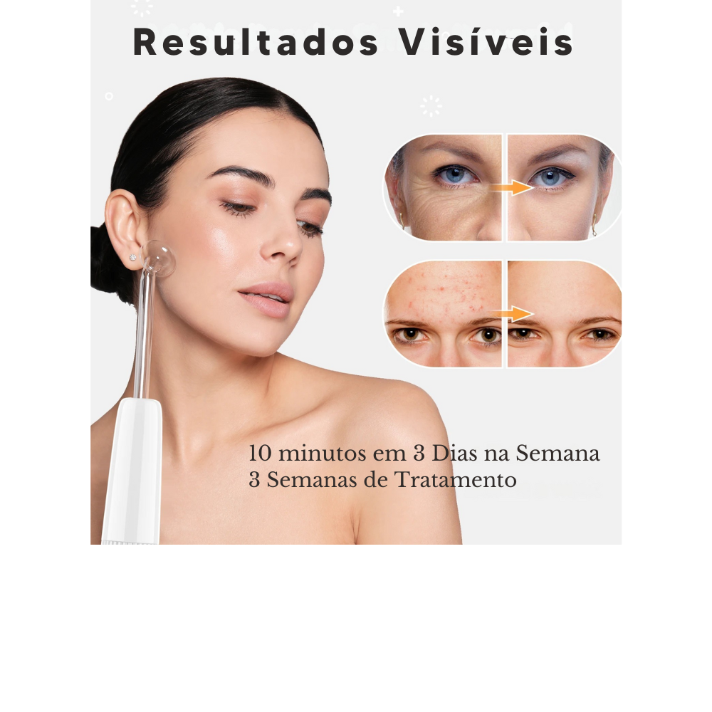 Aparato de Alta Frecuencia Profesional Darsonval – Kit Facial y Capilar