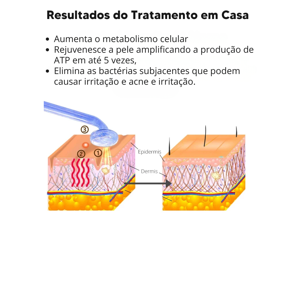 Aparato de Alta Frecuencia Profesional Darsonval – Kit Facial y Capilar