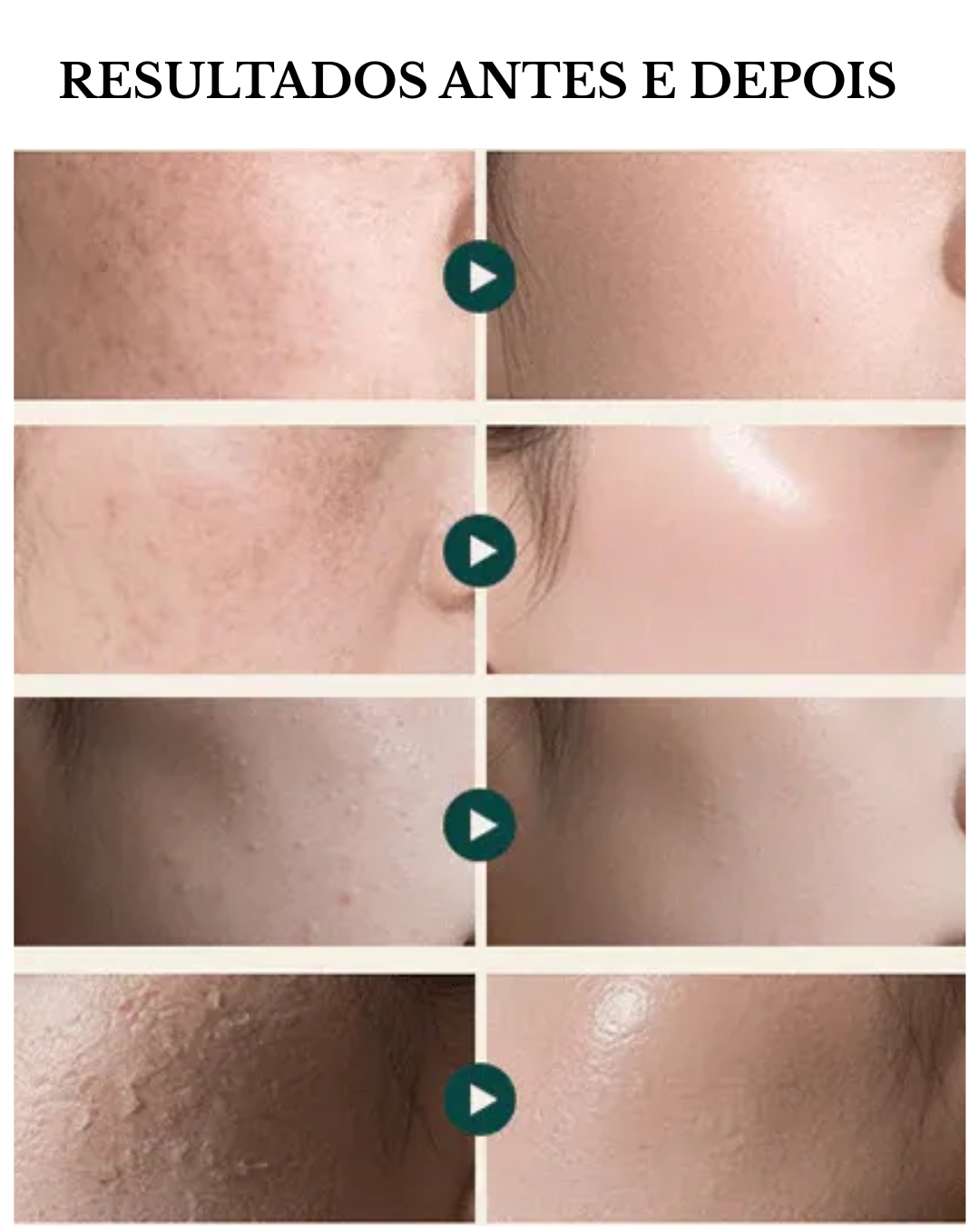 RejuAll Advanced PDRN Revitalizing Cream – 99% PDRN de Salmón de Alta Pureza