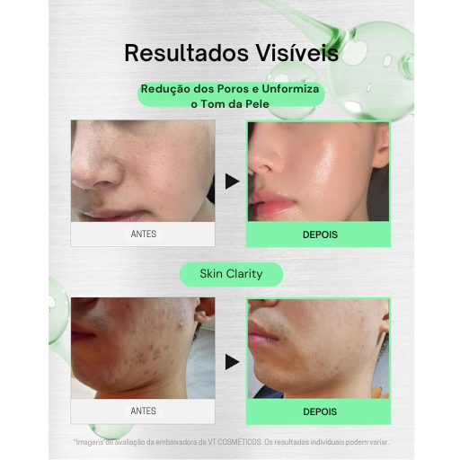Sérum VT Cica Reedle Shot 100 Microneedling con Exosomas para Piel