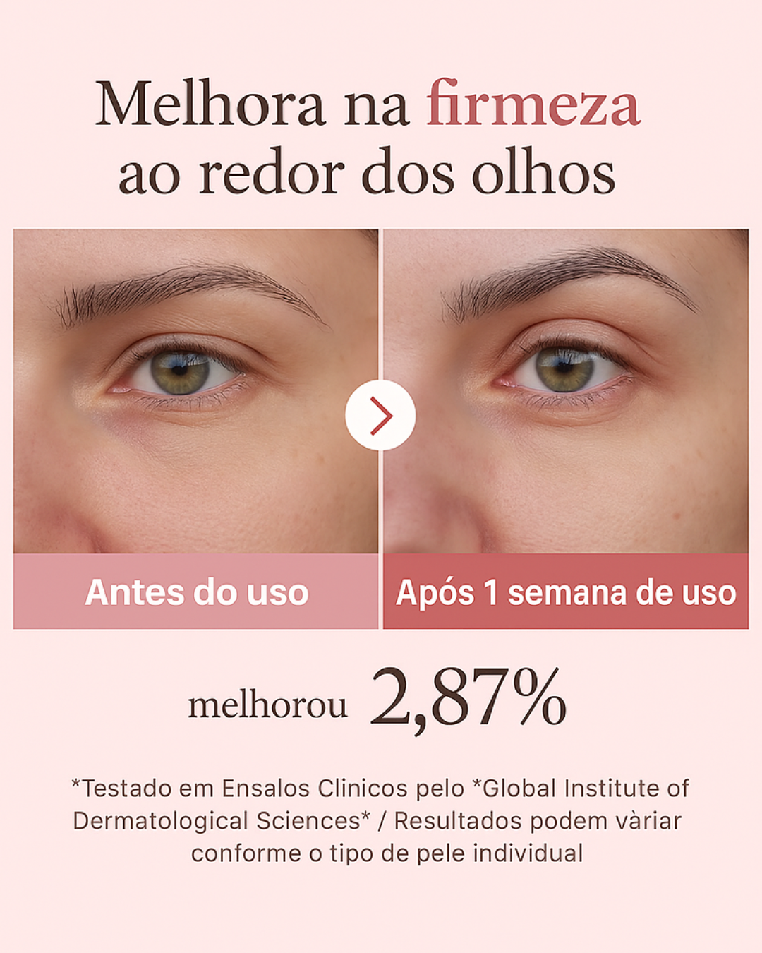 Crema para el Contorno de Ojos Medicube con Retinol 99 % Puro y PDRN de Salmón ✨